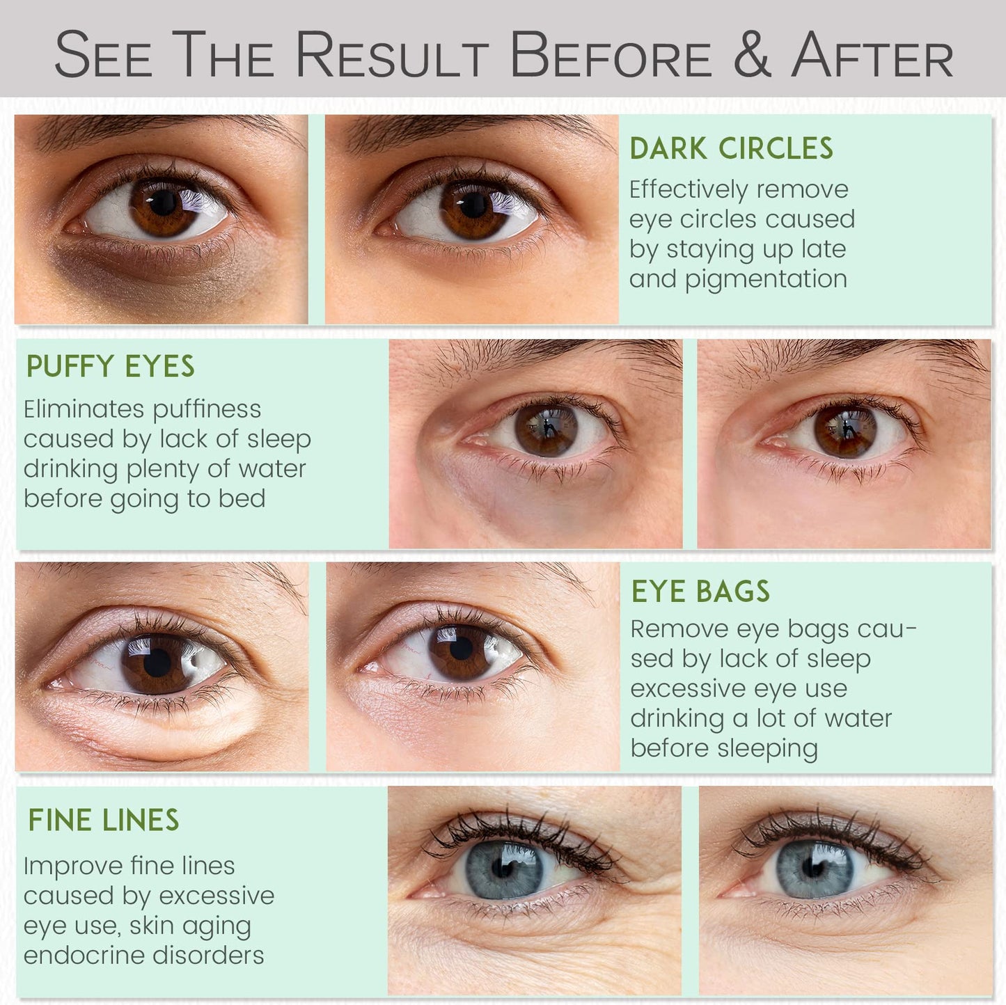 Under Eye Patches - 60 Pcs - 24K Gold Eye Mask- Puffy Eyes & Dark Circles Treatments,Reduce Under Eye Bags and Smooth Wrinkles,Eye Skin Care Pads With Collagen,Hyaluronic Acid & Castor Oil