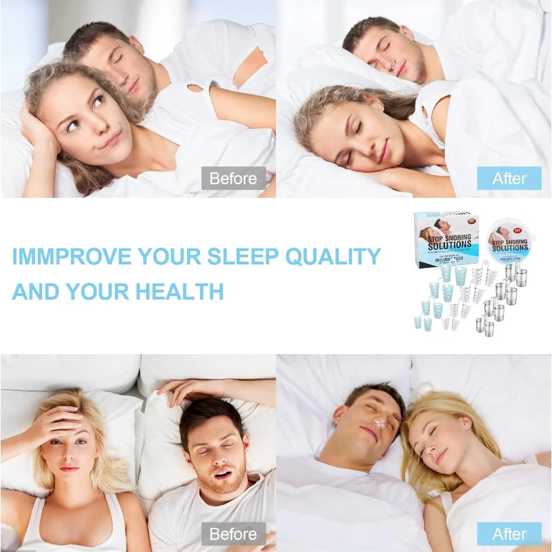 4PCS Anti Snoring Nasal Dilator For Easy Breathing Preventing Snoring Making It Better For Respiratory Health Care
